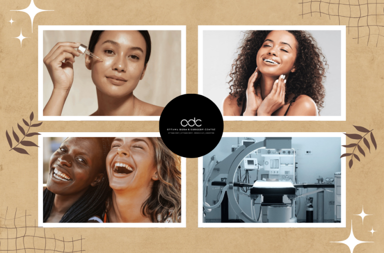 Instant Botox Solutions in Ottawa for a Quick Refresh