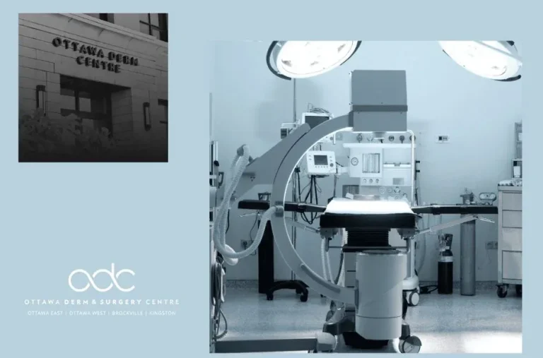 Plastic Surgery Near Me | Ottawa Derm & Surgery Centre Plastic Surgery Near Me | Ottawa Derm & Surgery Centre