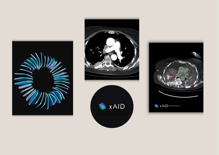 Boost Local CT Reads with AI Radiology Reporting Boost Local CT Reads with AI Radiology Reporting