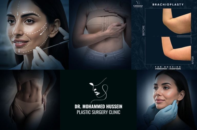 أفضل دكتور تجميل في مصر لمرضى الكويت مع استشارة آمنة